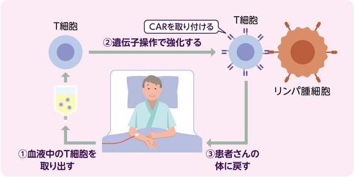 CAR T細胞療法のしくみ