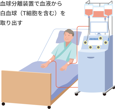 血球分離装置で血液から白血球（T細胞を含む）を取り出す