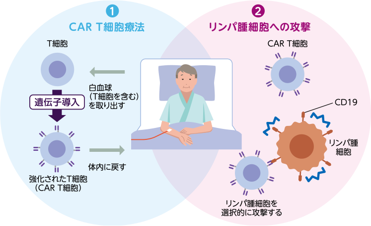 イエスカルタによる治療のしくみ